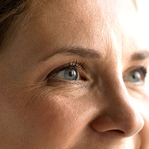 Microneedling