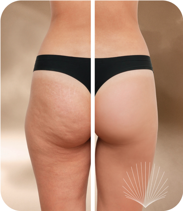 Before and after transformation