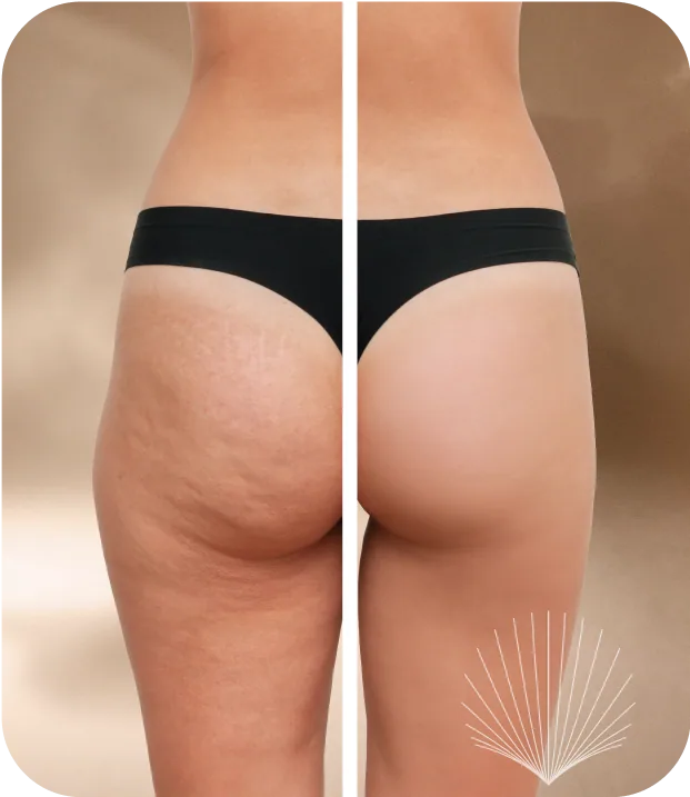 Before and after transformation