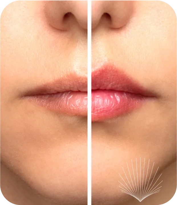 Before and after transformation