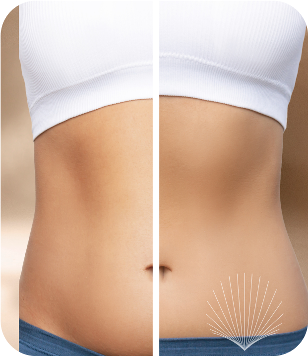 Before and after transformation