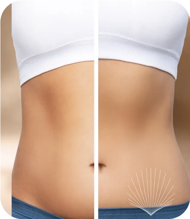 Before and after transformation