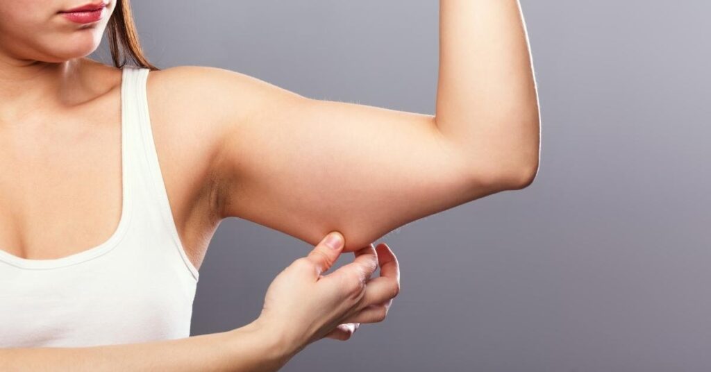 Bat Wings Arms Fat Liposuction Omaha