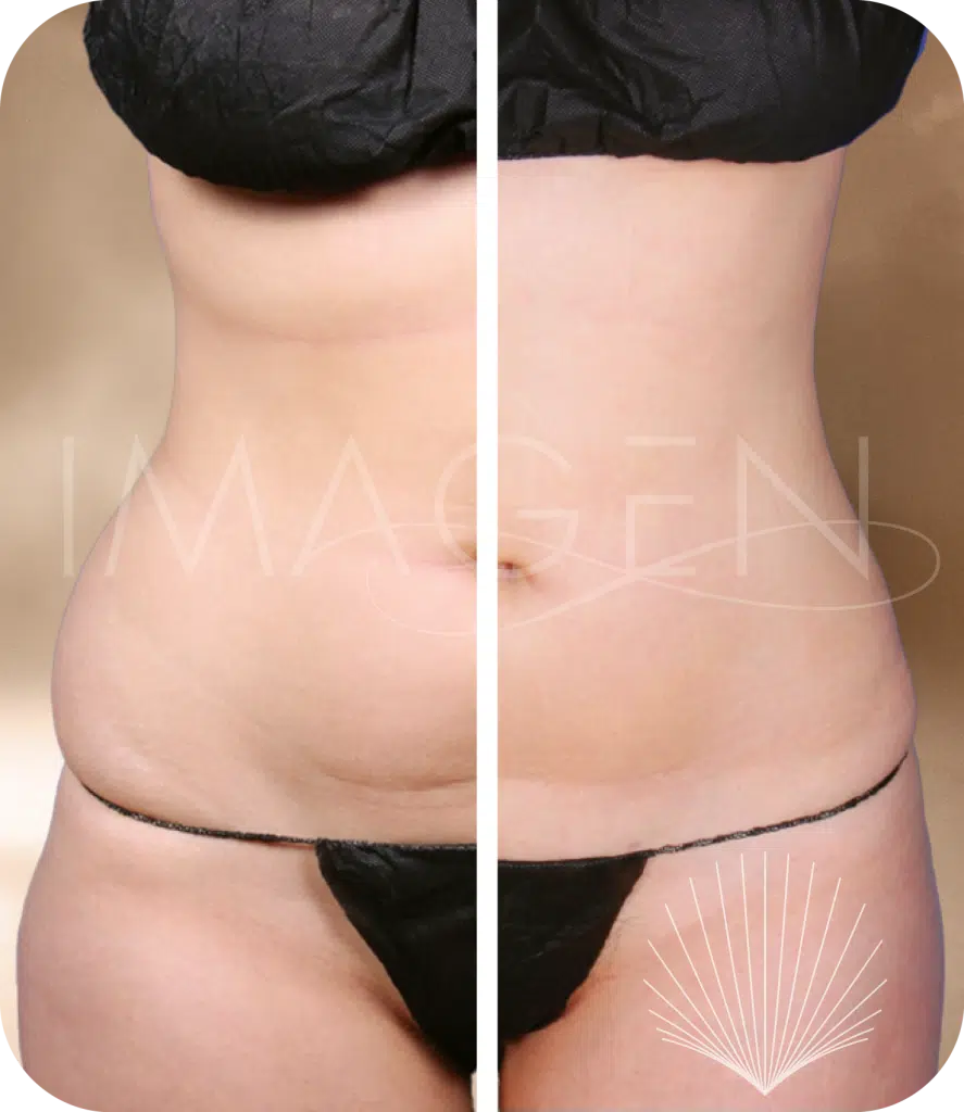 Before and after