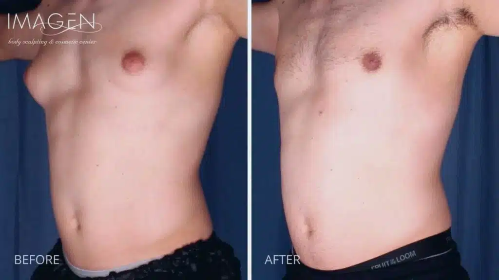 Before and after