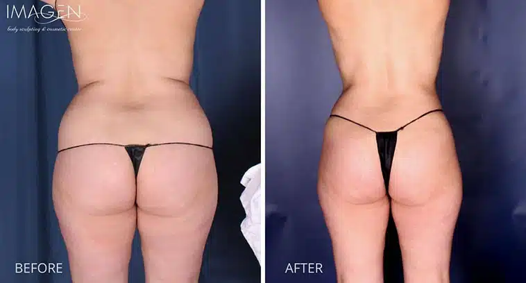 Before and after