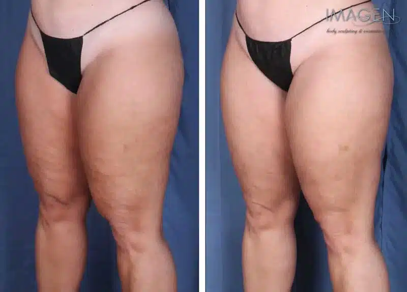 Before and after