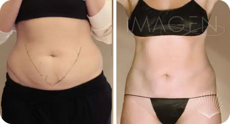 Before and after