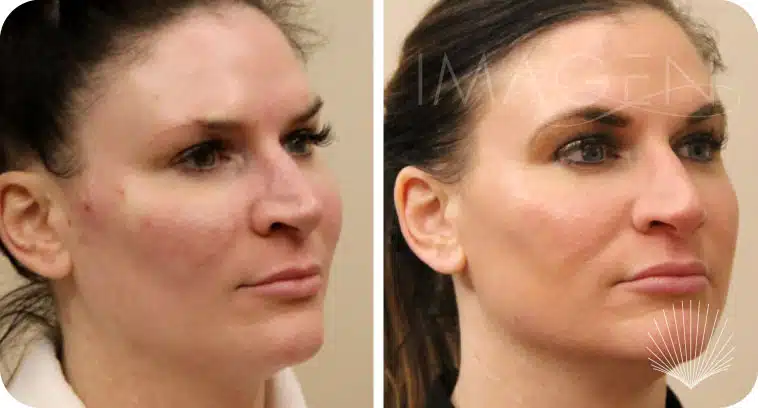 Before and after