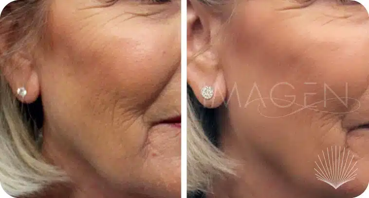Before and after