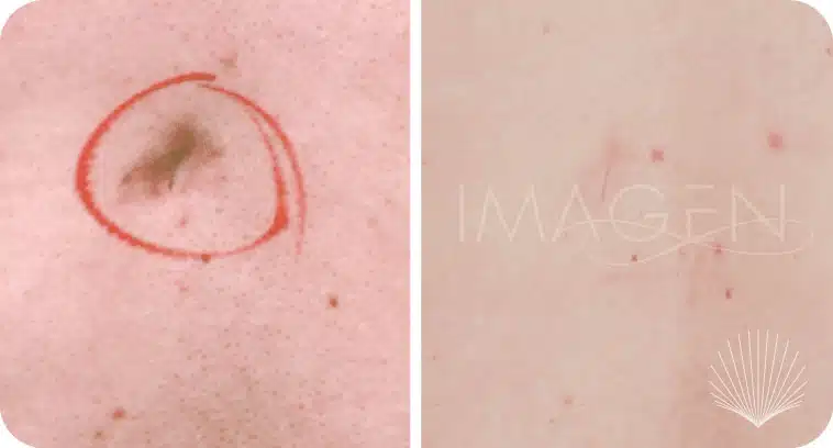 Before and after