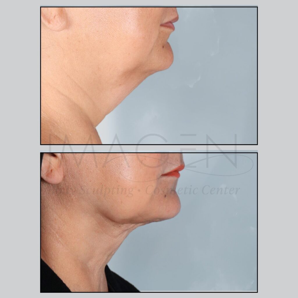 BA-neck-10.jpg