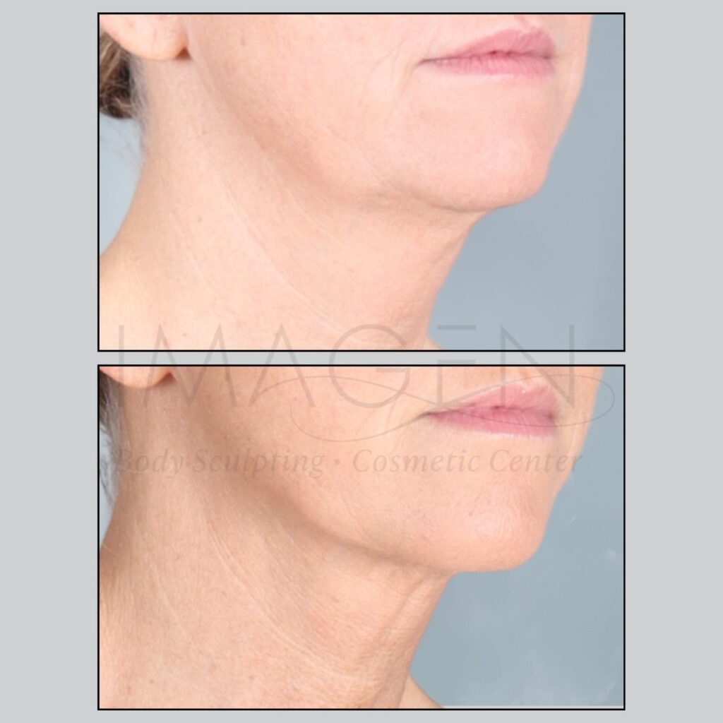 BA-neck-2.jpg
