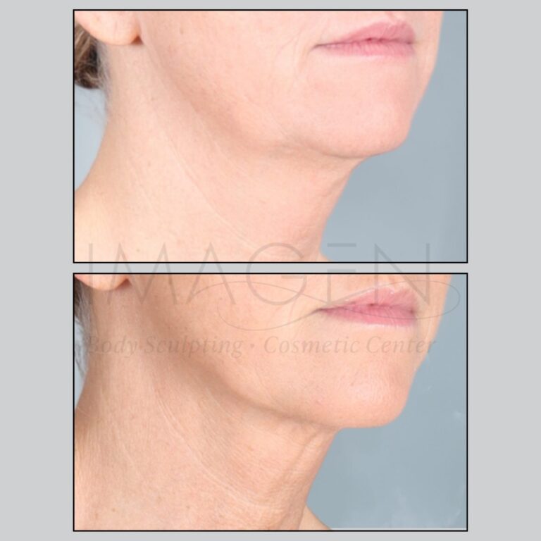 BA-neck-2.jpg