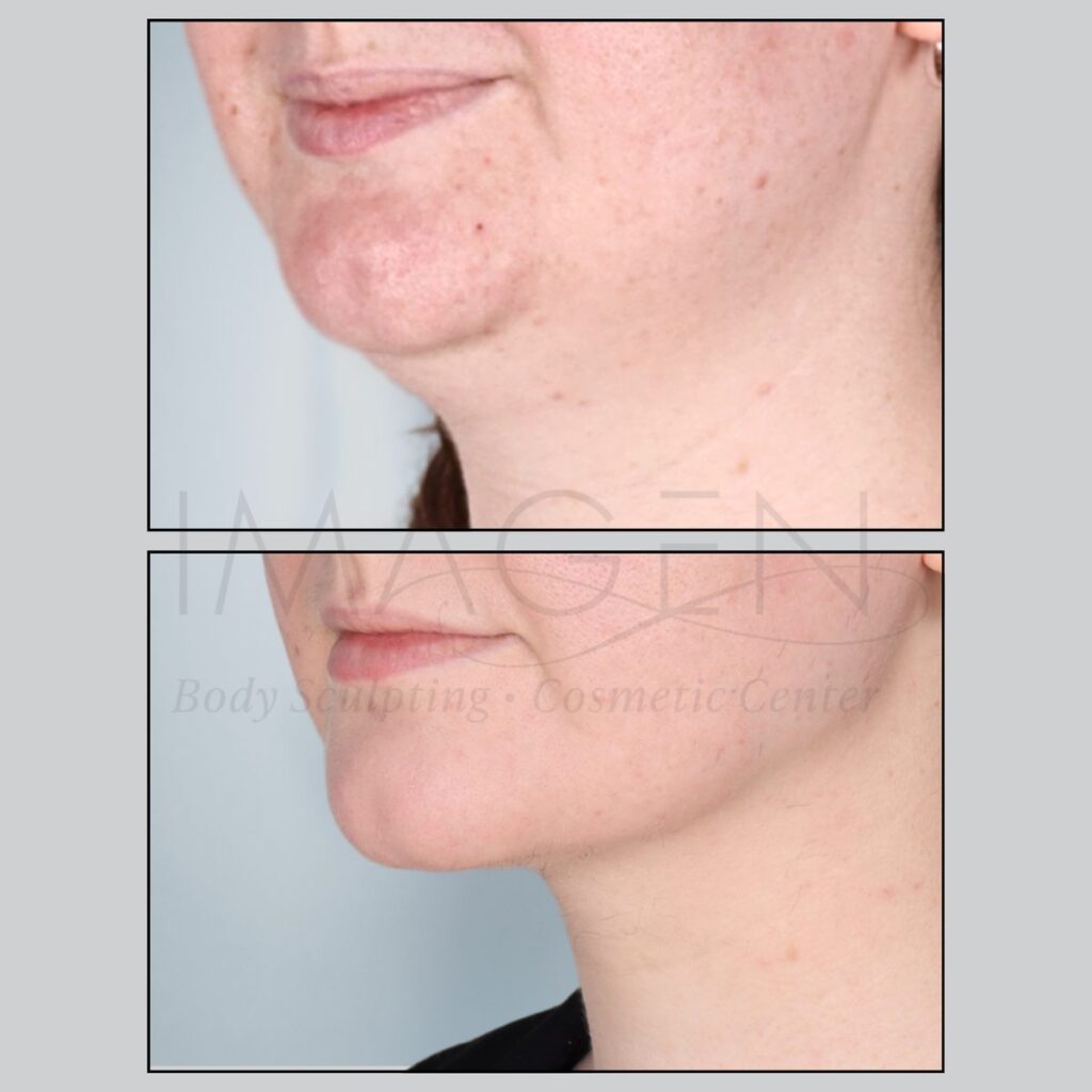 BA-neck-3.jpg