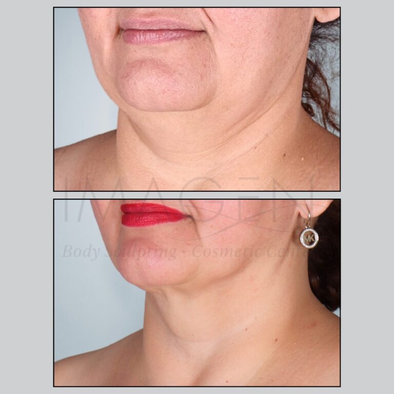 BA-neck-4.jpg