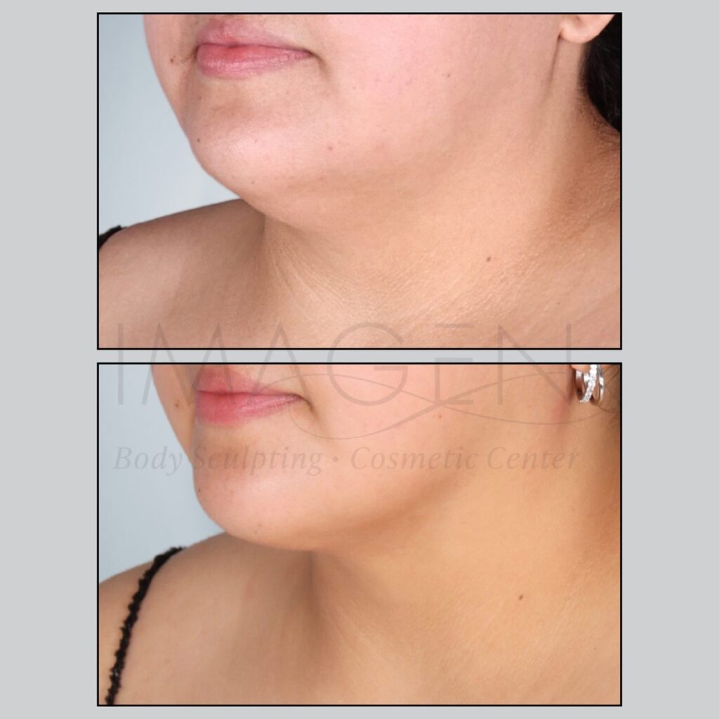 BA-neck-5.jpg