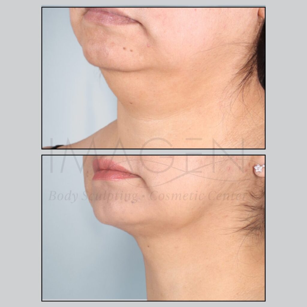 BA-neck-6.jpg