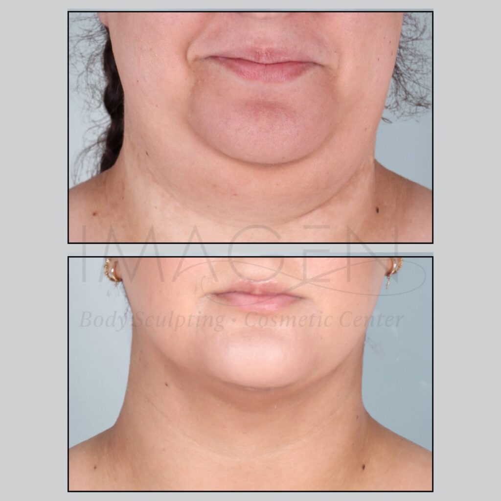 BA-neck-7.jpg