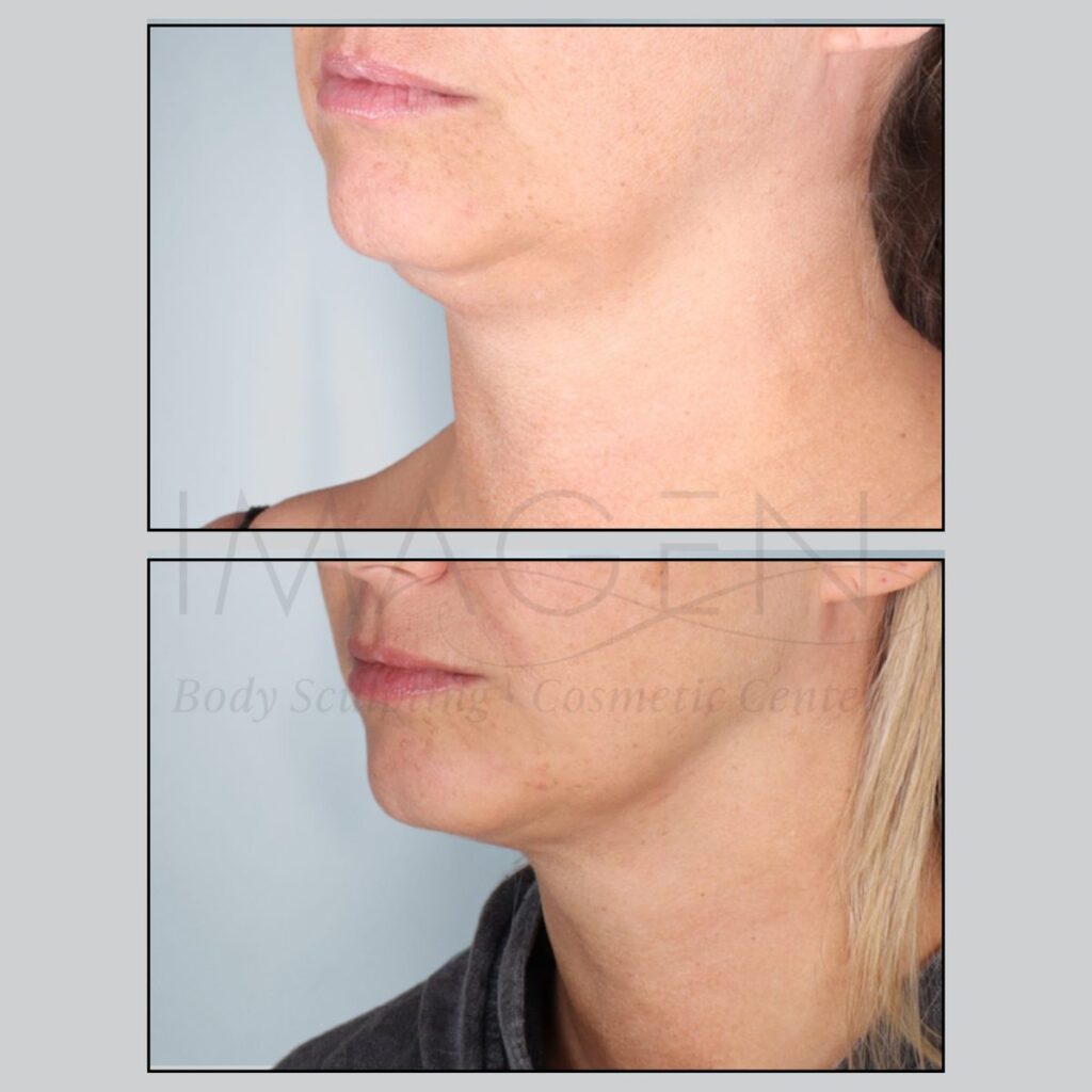 BA-neck-8.jpg