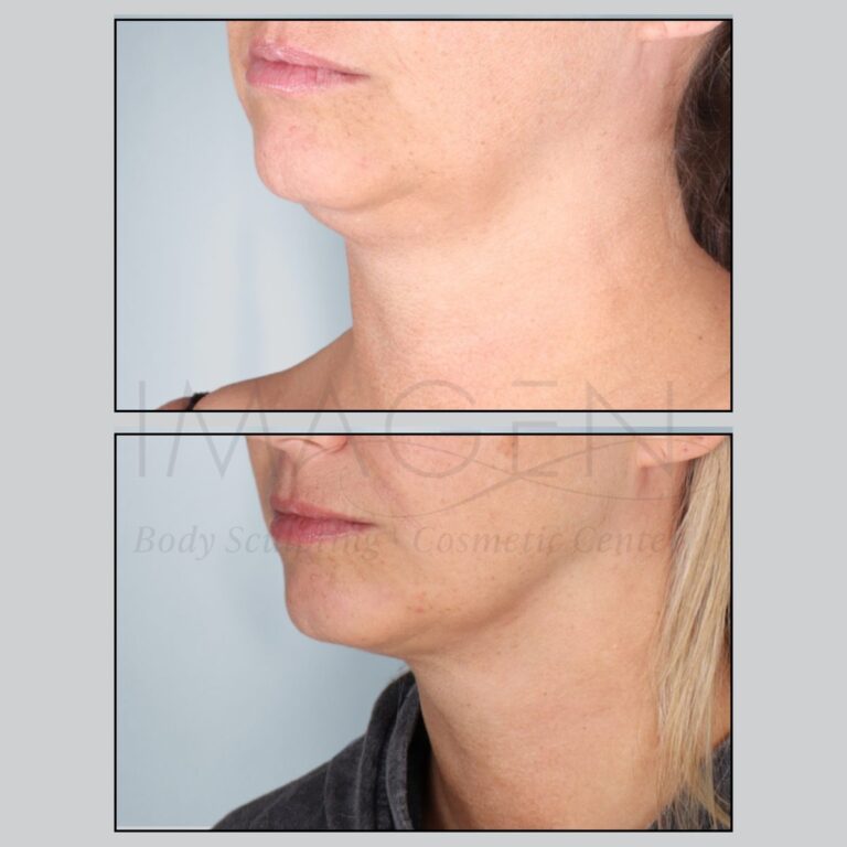 BA-neck-8.jpg