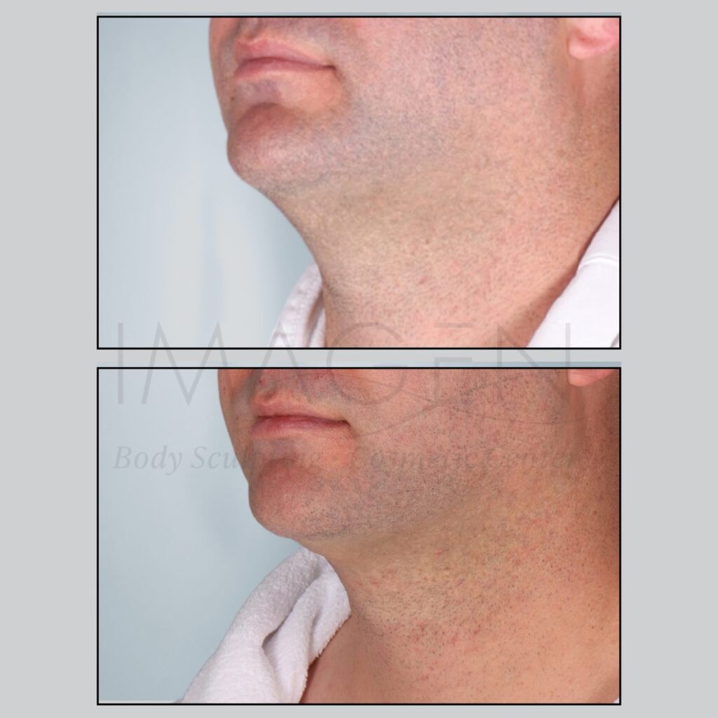 BA-neck-9.jpg