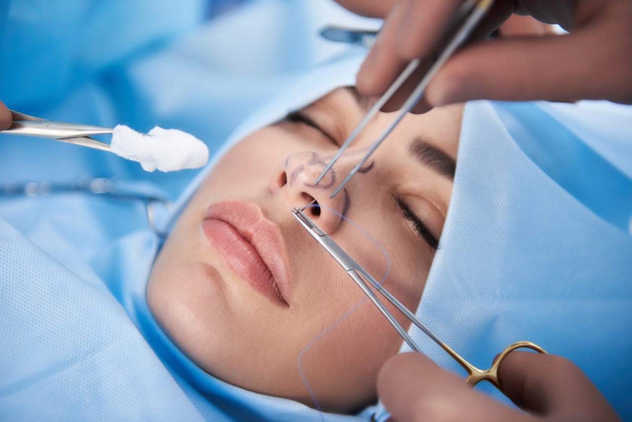 Rhinoplasty recovery